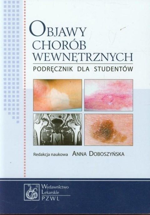 Objawy chorób wewnętrznych